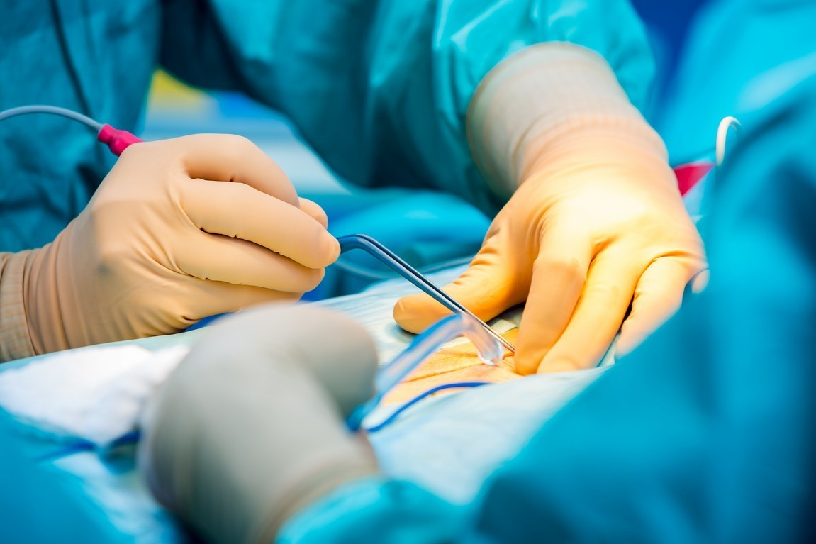 Electrosurgery: what is it, how does it work, and what are the benefits?